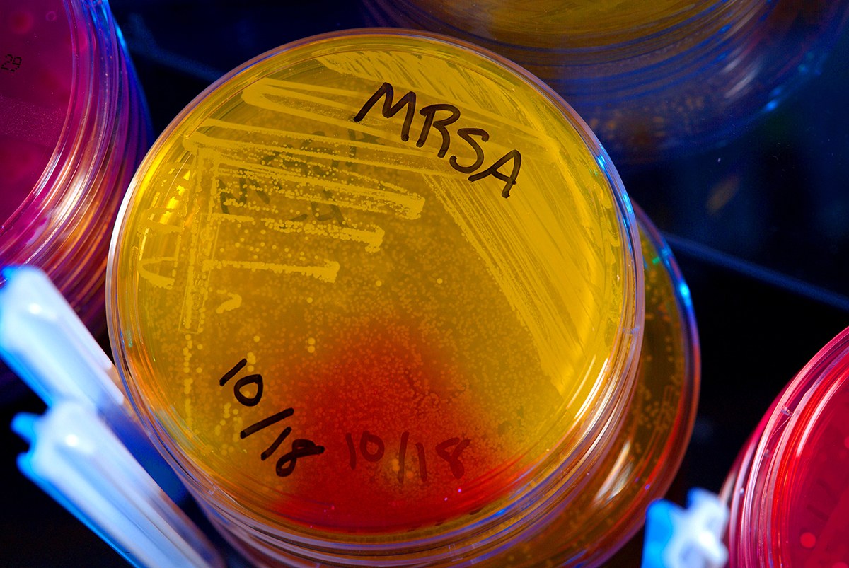 mrsa bacteria